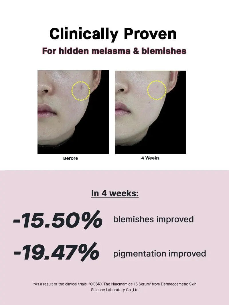 COSRX The Niacinamide 15 Serum 20 ml - JOLIE'S