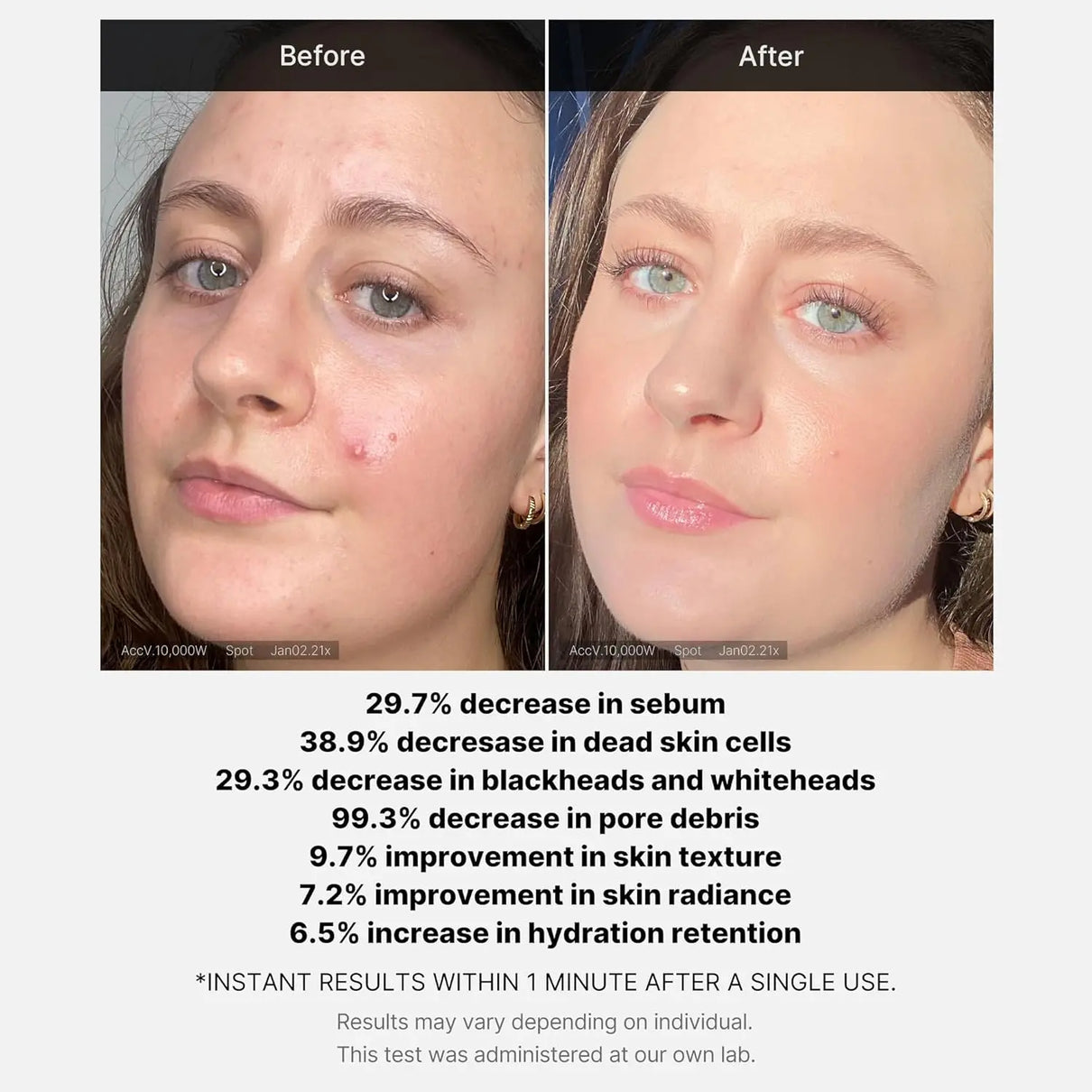 MEDICUBE Red Acne Succinic Acid Peel Serum 40 gm Medicube JOLIE'S