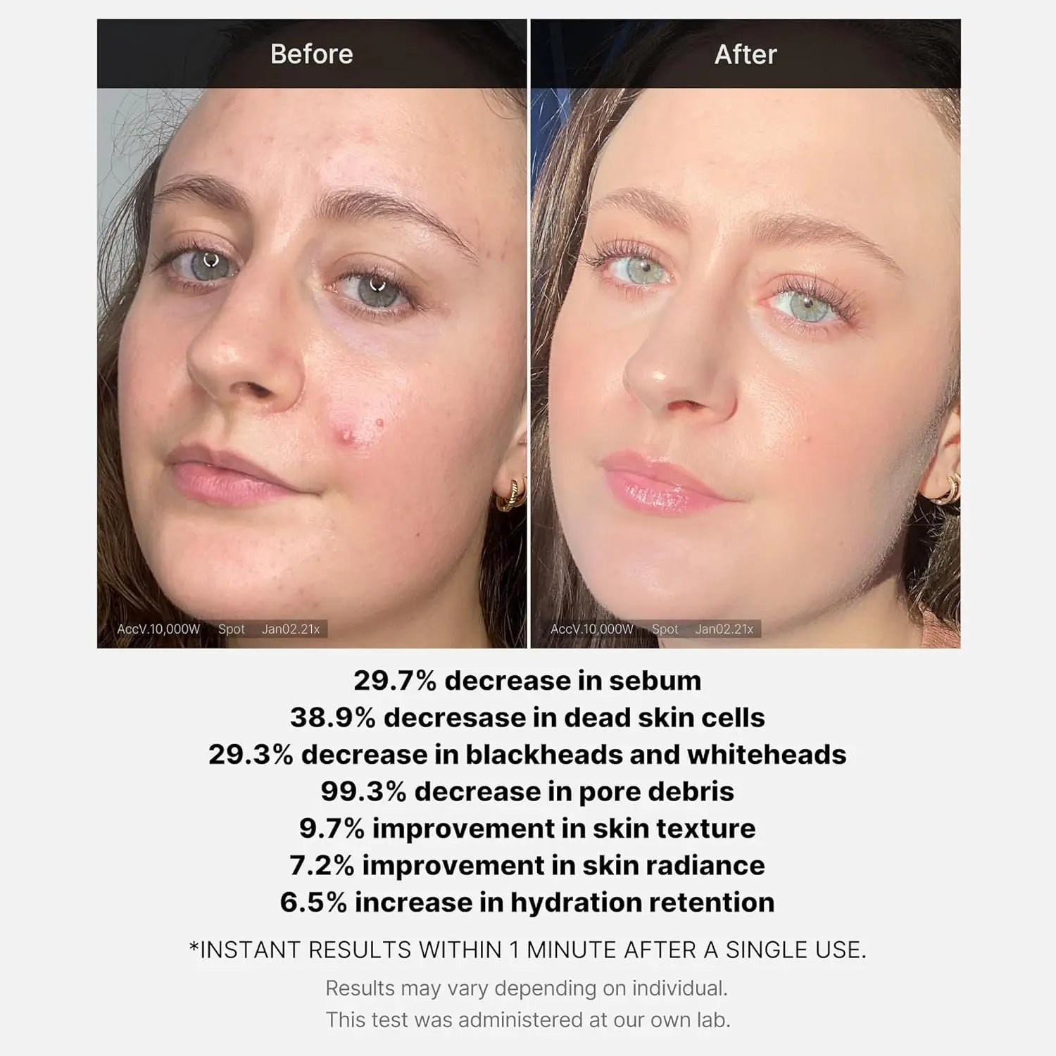 MEDICUBE Red Acne Succinic Acid Peel Serum 40 gm Medicube JOLIE'S