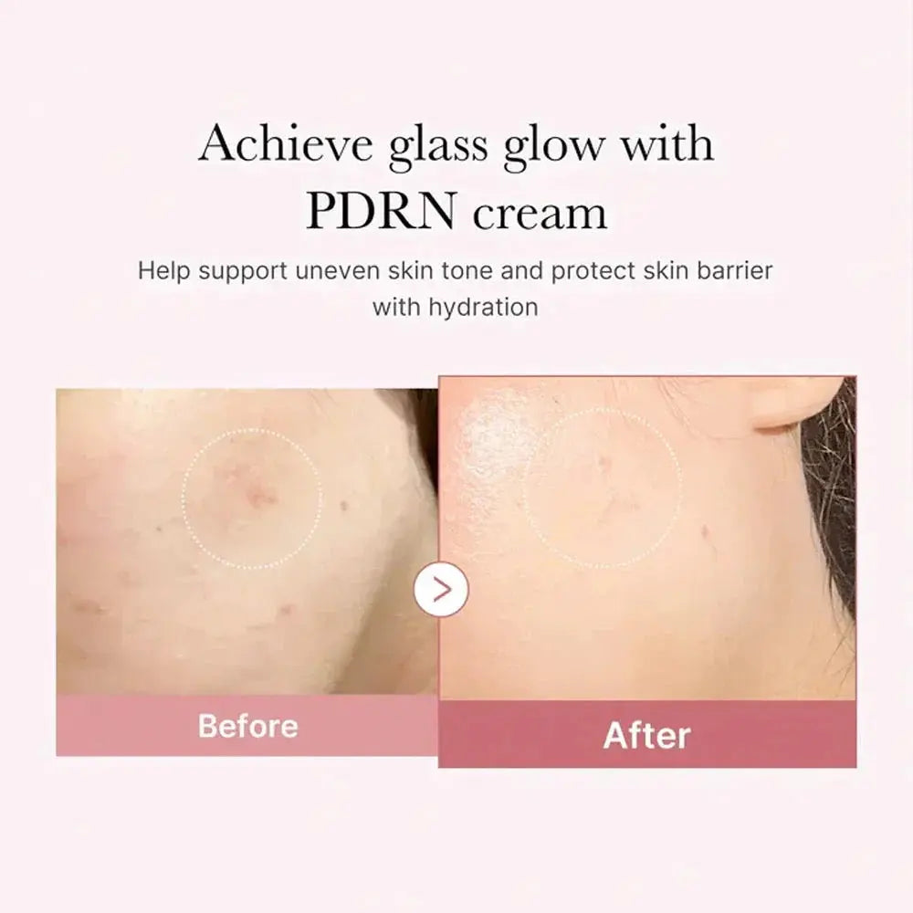 Medicube PDRN Pink Hyaluronic Moisturizing Cream (50ml) Medicube
